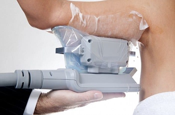 fat freezing arms Oxfordshire