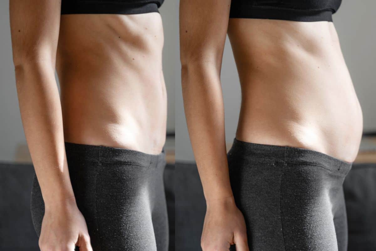 How long does diastasis recti take to improve Oxfordshire?