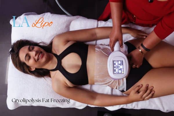 woman getting cryolipolysis Oxfordshire