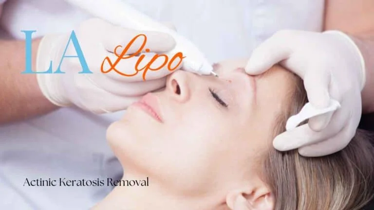 Woman receiving Actinic Keratosis Removal Treatment Oxfordshire