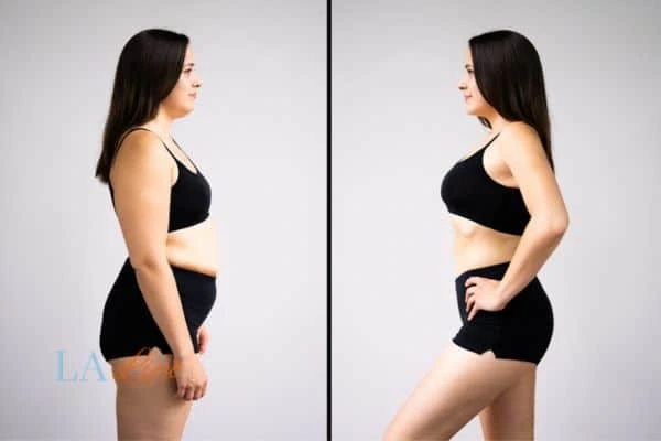 LA-EMS Body Sculpting Oxfordshire results before and after of womans results on body toning.
