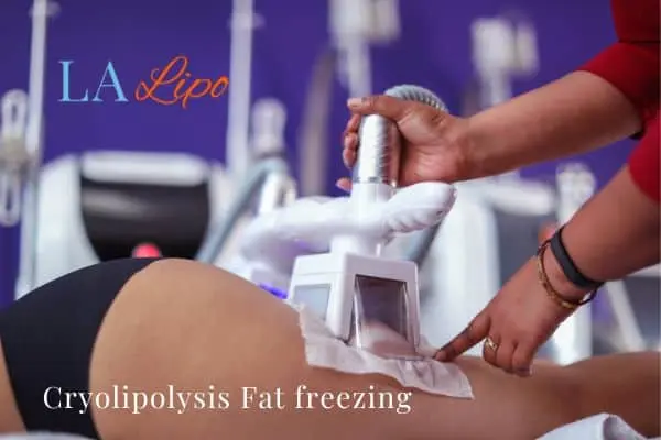women getting fat freezing Oxfordshire