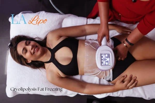 woman getting cryolipolysis Oxfordshire