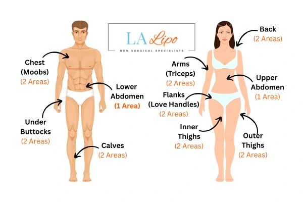 LA LIPO Cryolipolysis Areas Oxfordshire