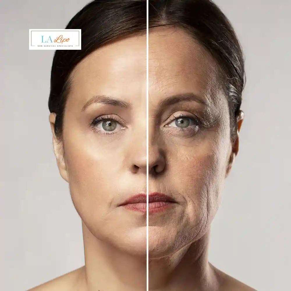 How Can You Tell If Non-Surgical Skin Tightening Is Right for You Oxfordshire?