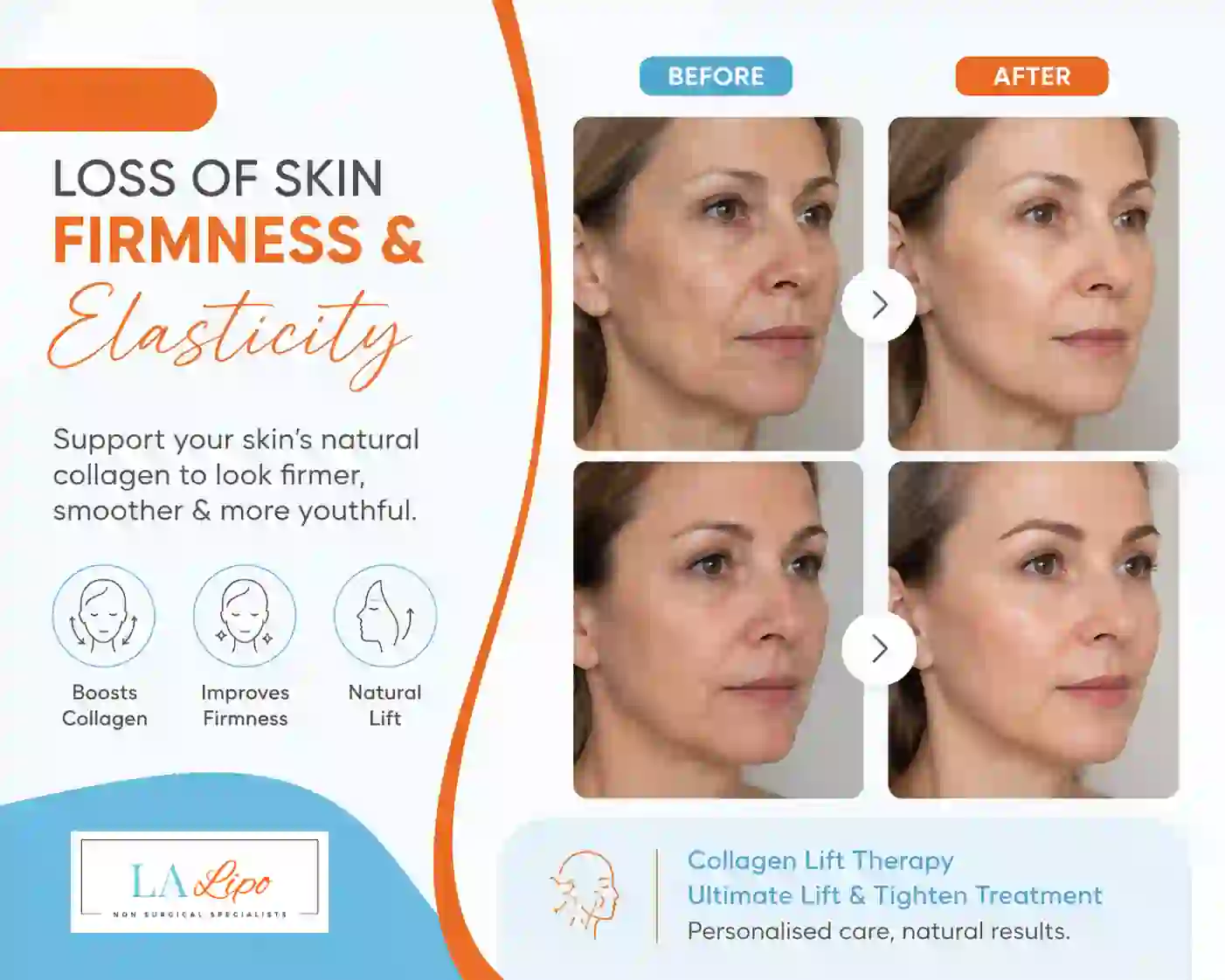Sign #7: Loss of Skin Firmness and Elasticity Oxfordshire