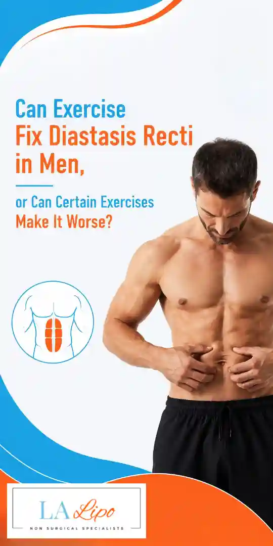 Can Exercise Fix Diastasis Recti in Men, or Can Certain Exercises Make It Worse Oxfordshire?